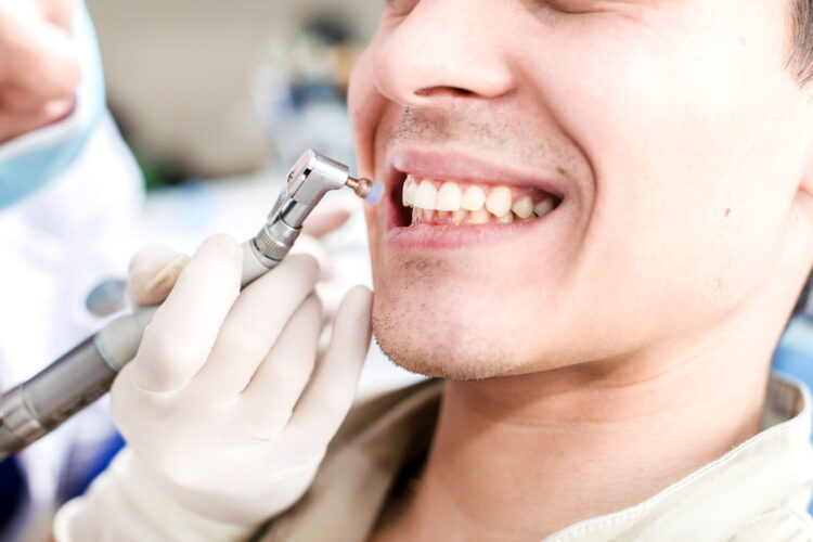 Tooth Cleaning In Ealing
